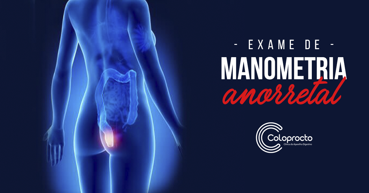 Exame de Manometria Anorretal